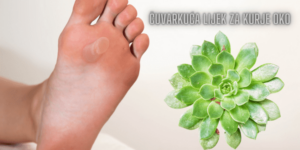 Čuvarkuća i kurje oko Iskustva