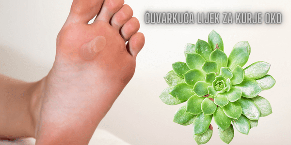 Čuvarkuća i kurje oko Iskustva