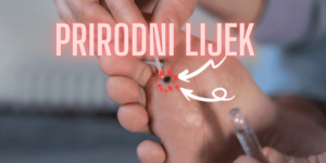 Read more about the article PRIRODNI LIJEK ZA KURJE OKO:Top 19 Recepata za ovaj problem